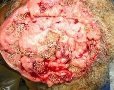 paraziti v človeških možganih